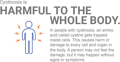 Cystine-crystal-Pain-Icon-Desktop