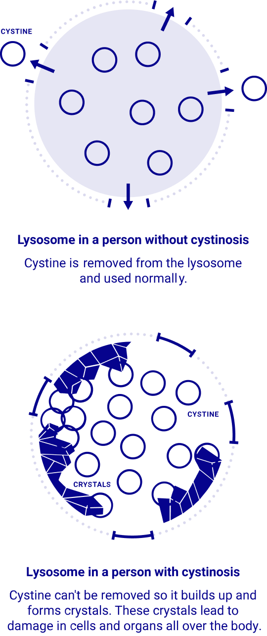 depiction of how cystine affects cells in the body
