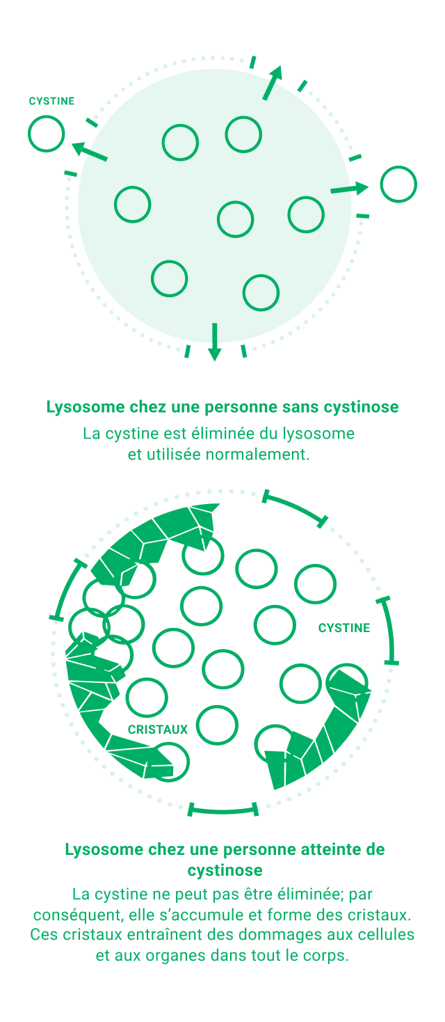 depiction of how cystine affects cells in the body
